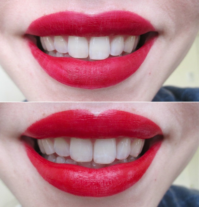 What Color Lipstick Makes Teeth Look Whiter? A Handy Guide To Getting
