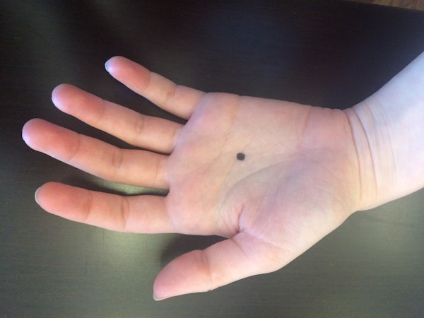 What Do Black Dots On Hands Mean? The Black Dot Campaign Is Helping