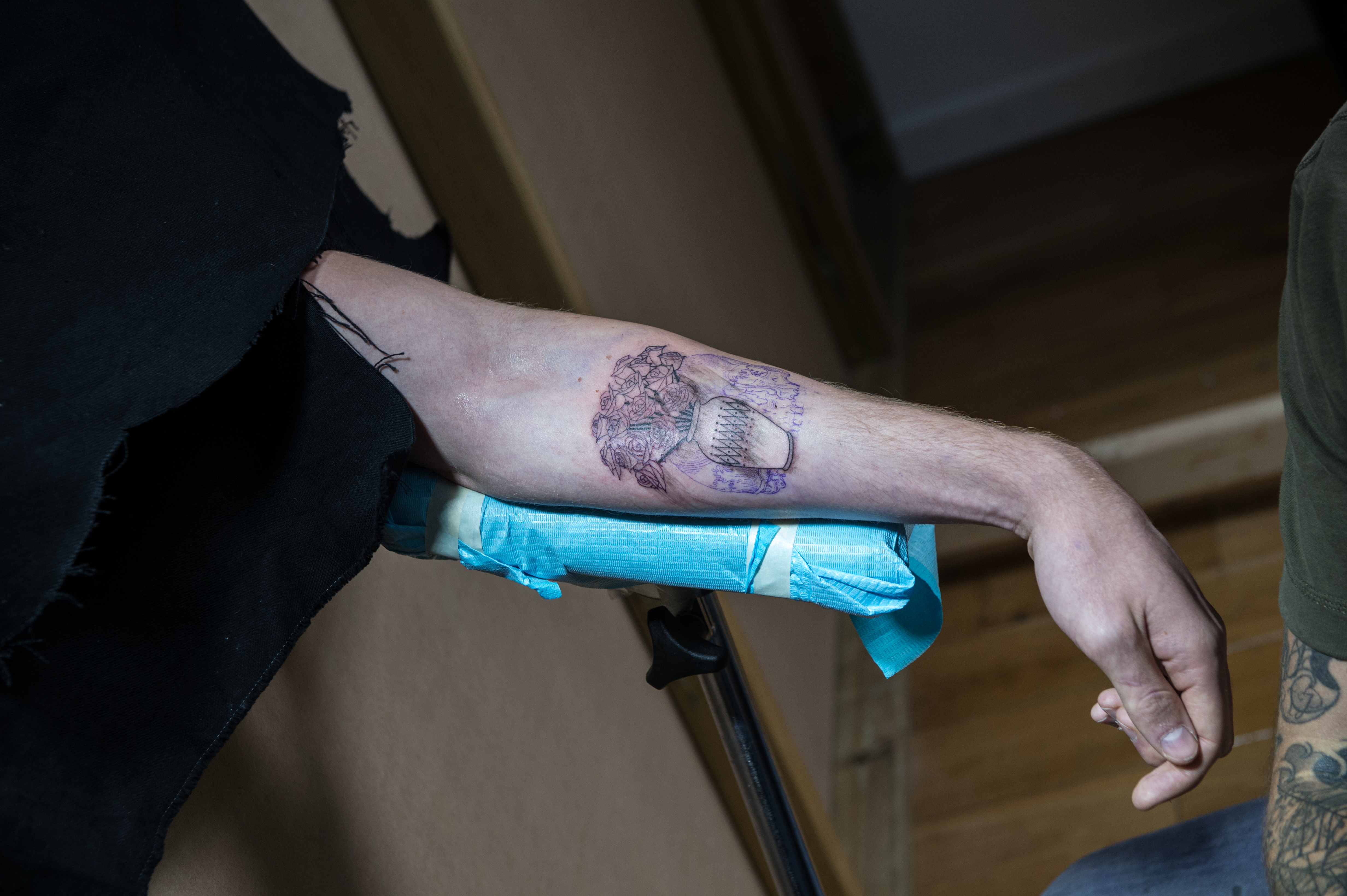 Cureus  Tinea and Tattoo A Man Who Developed TattooAssociated Tinea  Corporis and a Review of Dermatophyte and Systemic Fungal Infections  Occurring Within a Tattoo  Article